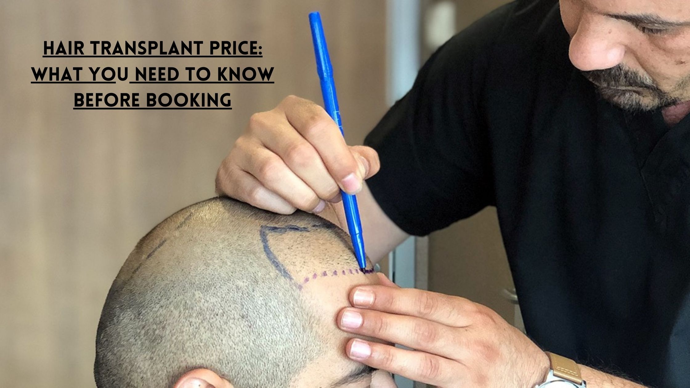 hair transplant price