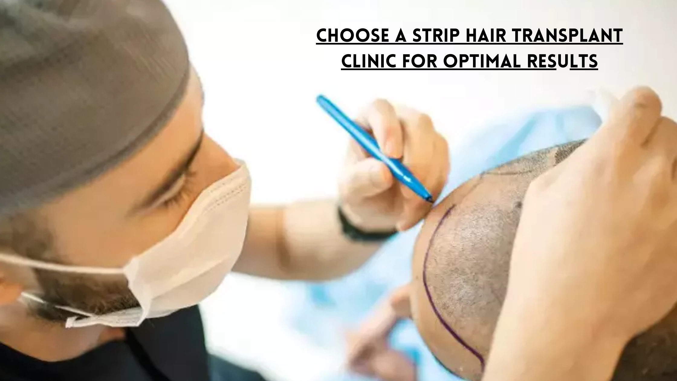 strip hair transplant clinic